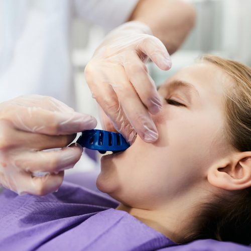 modelodental1